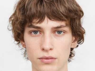 北京肿眼泡手术排名前三医院的任你对比挑选!