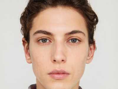 驻马店地区植发医院与医生综合实力盘点：专业应对大面积脱发问题的人气机构与医师解析